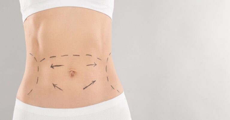 Cost of Tummy Tuck in Dubai