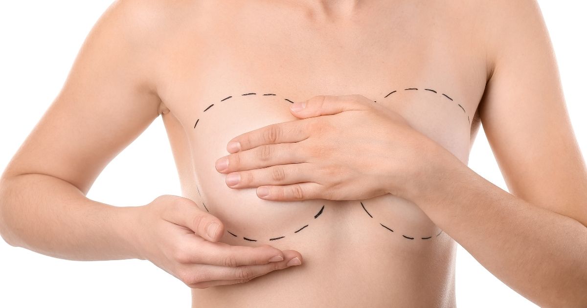 Cost of a Breast Lift Surgery in Dubai