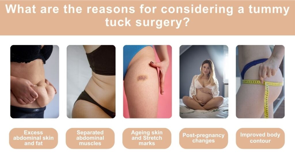Pros and Cons of Tummy Tuck Surgery