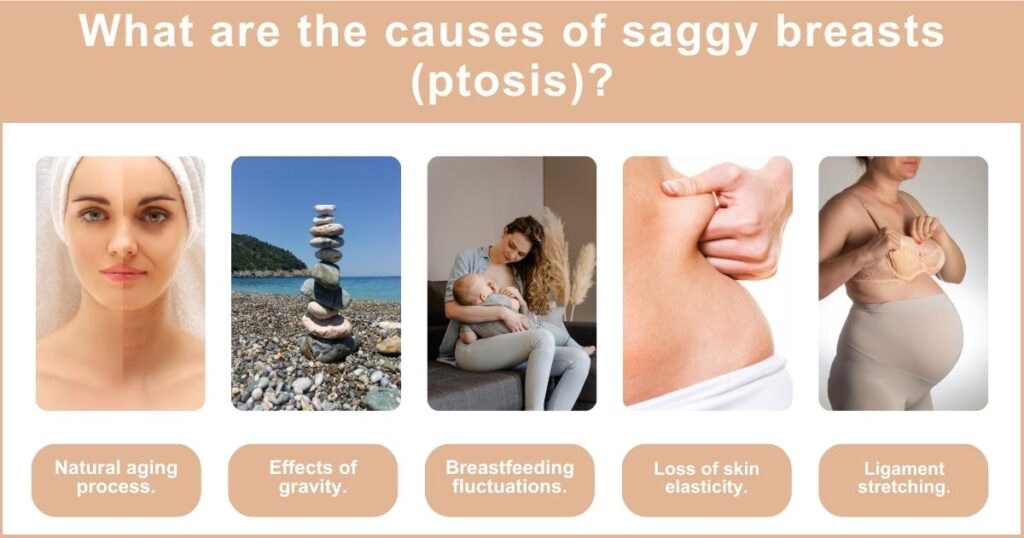 Addressing Saggy Breasts Is a Lift Your Best Option .What are the causes of saggy breasts ptosis | 2024