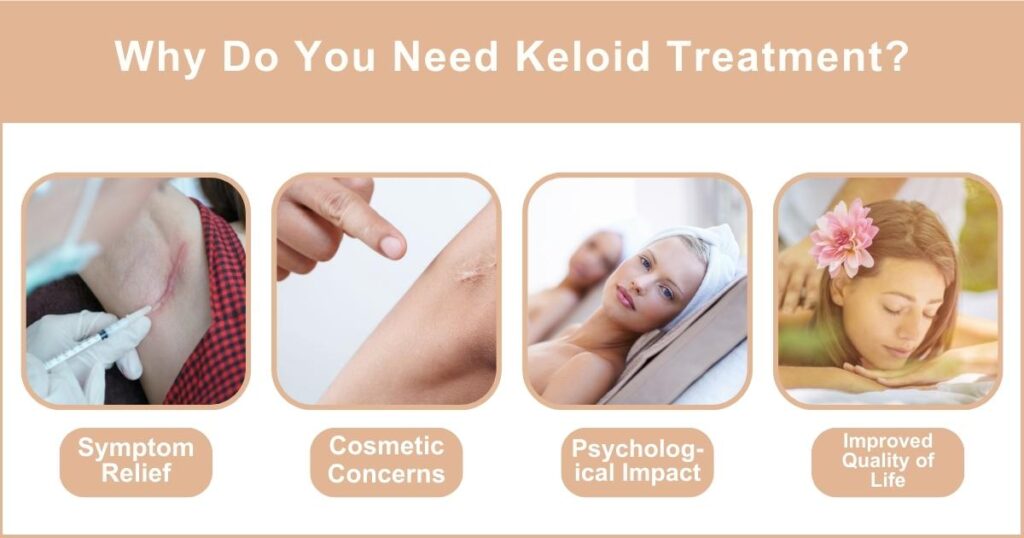 Best Keloid Treatments in Dubai