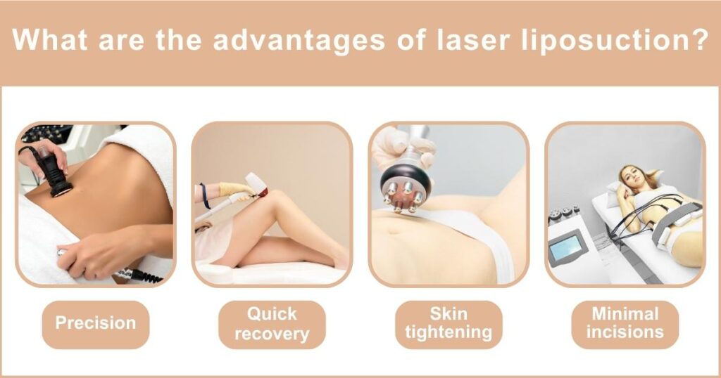 Best Laser Liposuction In Dubai.What are the advantages of laser liposuction | 2024