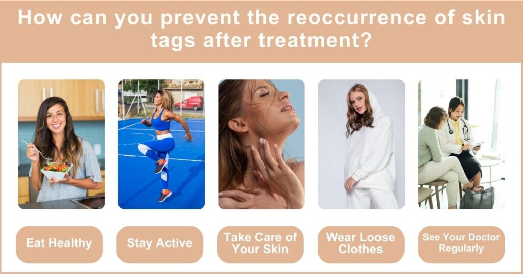 Safe Skin Tag Removal Methods 