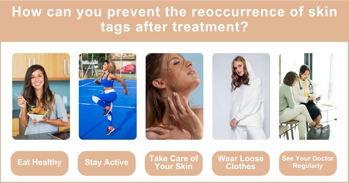 Safe Skin Tag Removal Methods | Recommended By Dr Shehzadi Tasneem
