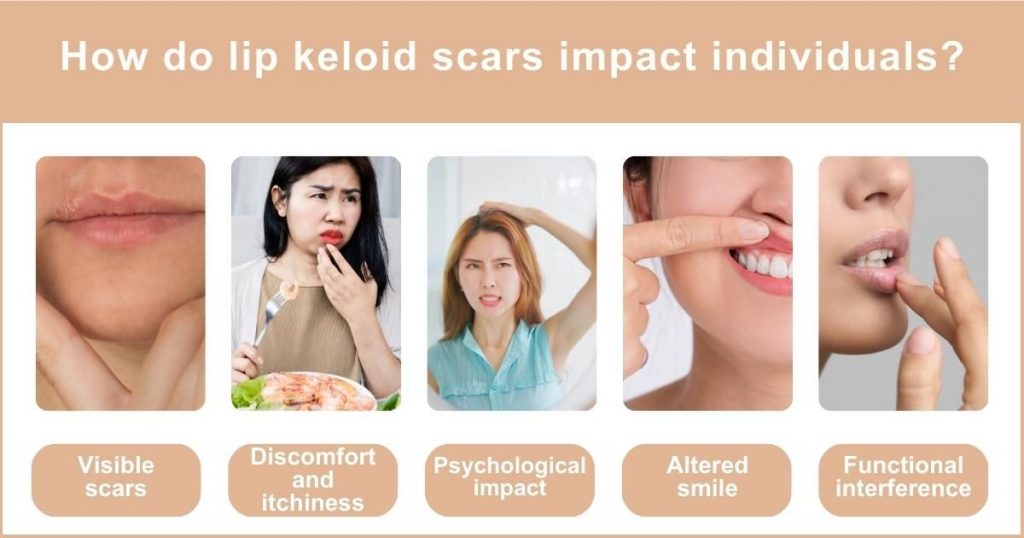 How Do Keloid Scars Affect the Lips?