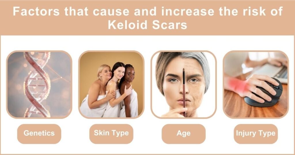 factors that cause and increase the risk of keloid scar