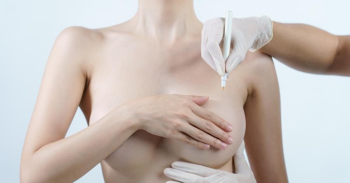 What Should You Know About Breast Augmentation CC Sizes
