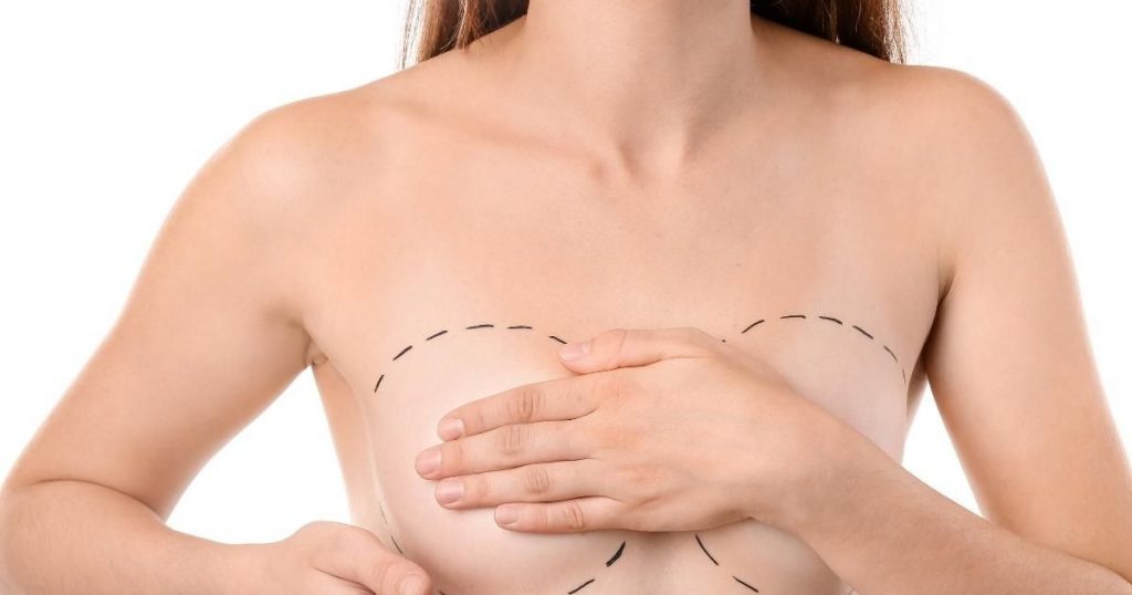 Role of Breast Augmentation CC Sizes in Overall Aesthetic Outcome