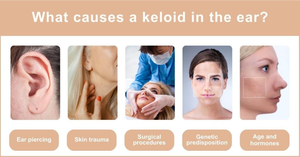 What causes a keloid in the ear