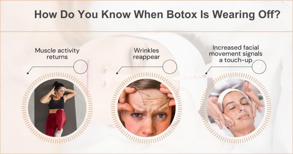Common Signs of Botox Wearing Off