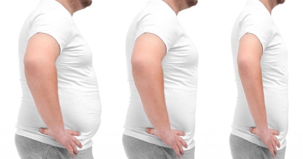 Managing Weight Post-Liposuction