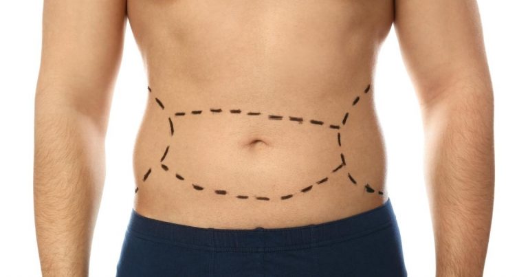 Non-Surgical Tummy Tuck Dubai: A Comprehensive Guide