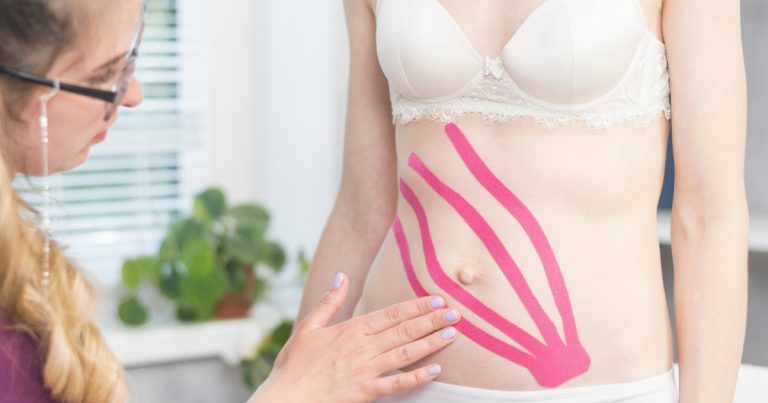 Tummy Tuck After C-Section: A Comprehensive Guide