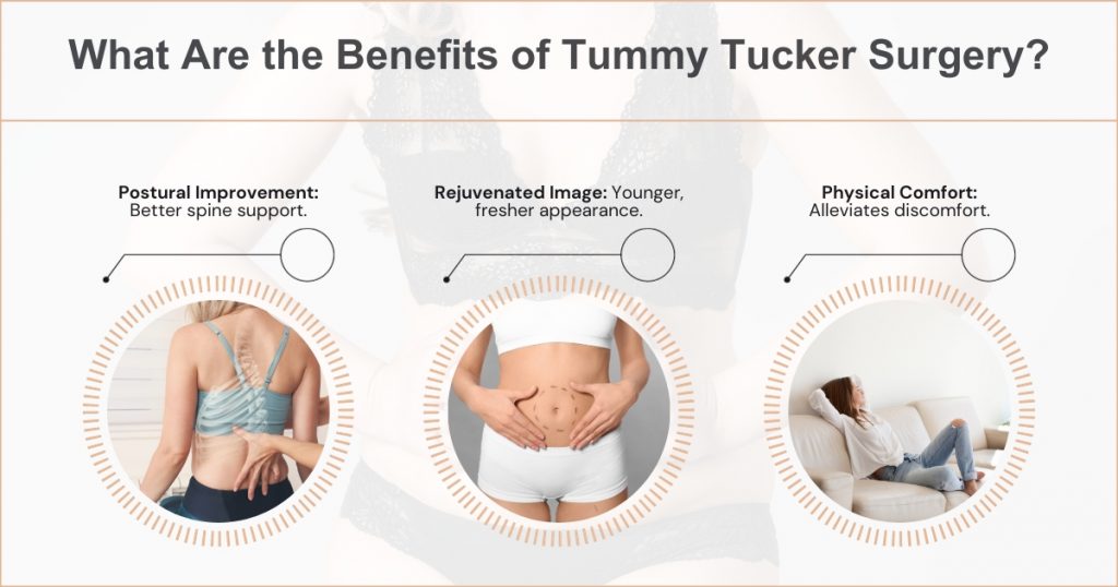 Benefits of Opting for a Tummy Tucker Surgery