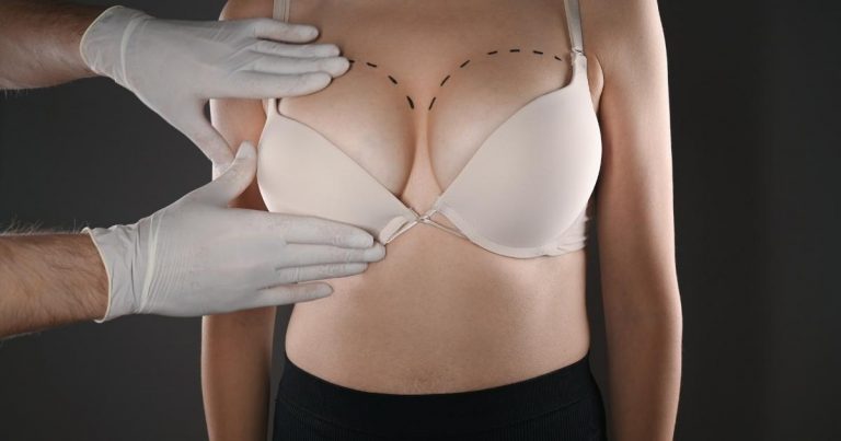 Breast Uplift Without Implants: All You Need to Know