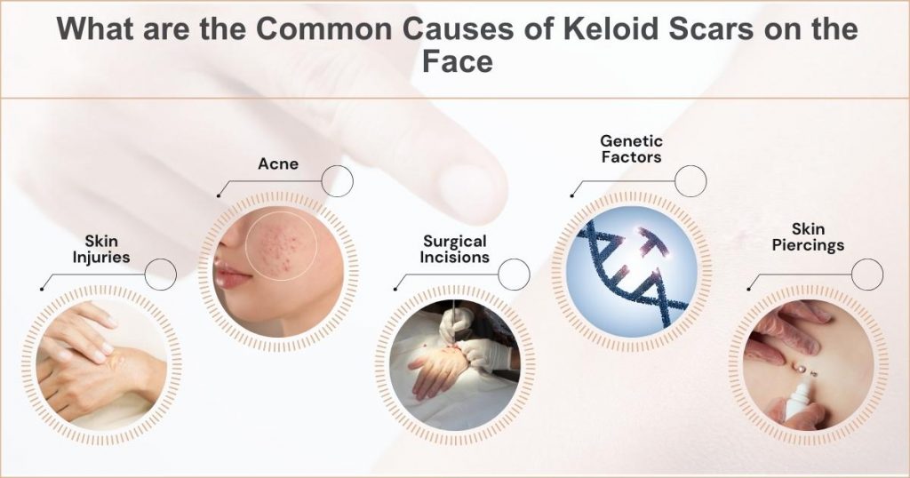 Common Causes of Keloid Scars on the Face