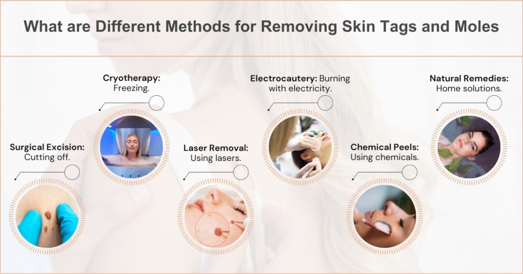 Different Methods for Removing Skin Tags and Moles