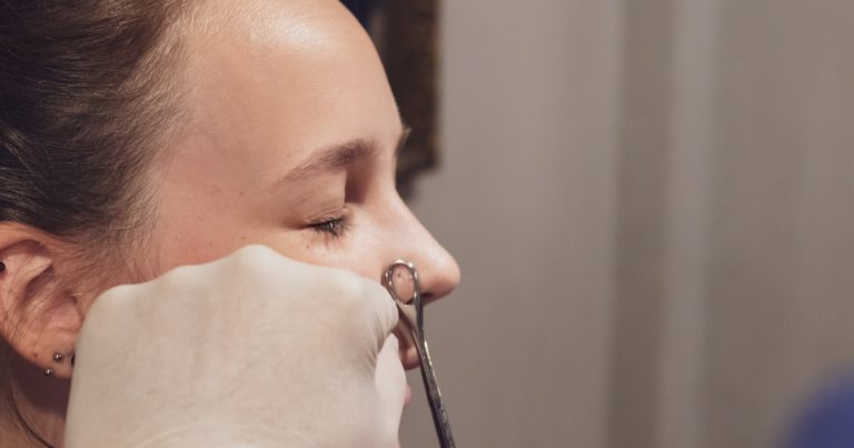 Keloid Scar Removal Nose Piercing