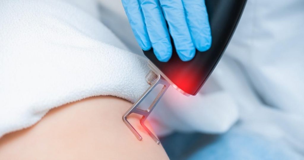 Laser Therapy for Keloid Scar Pain Treatment_ What to Expect