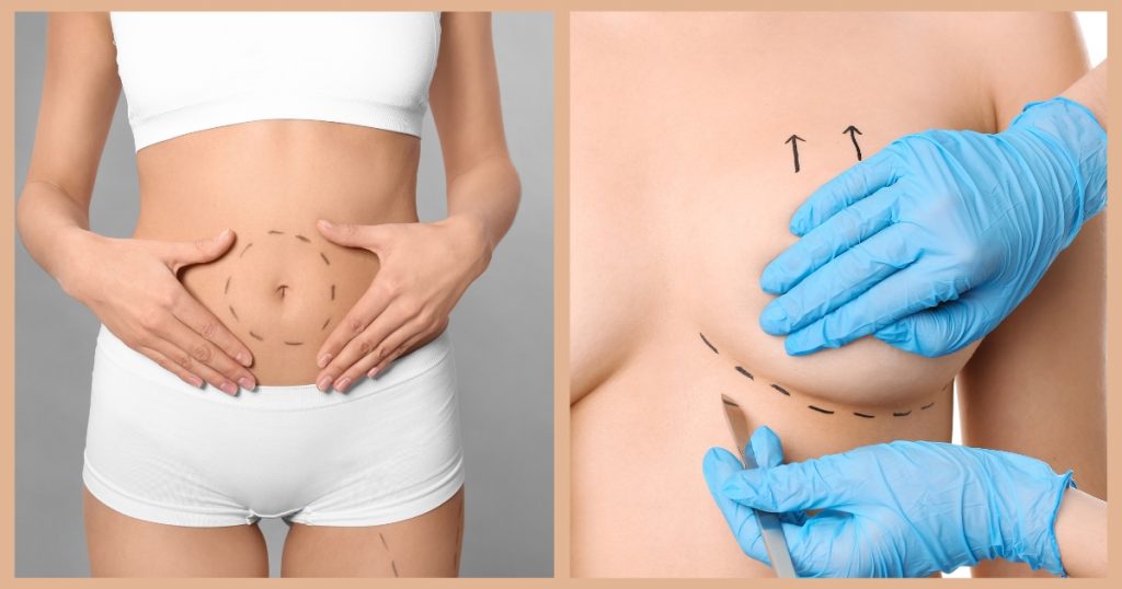 Recovery Process for Combined Tummy Tuck and Breast Augmentation