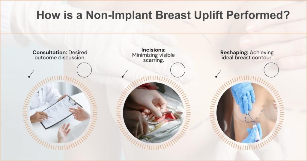 The Procedure_ Steps Involved in a Non-Implant Breast Uplift