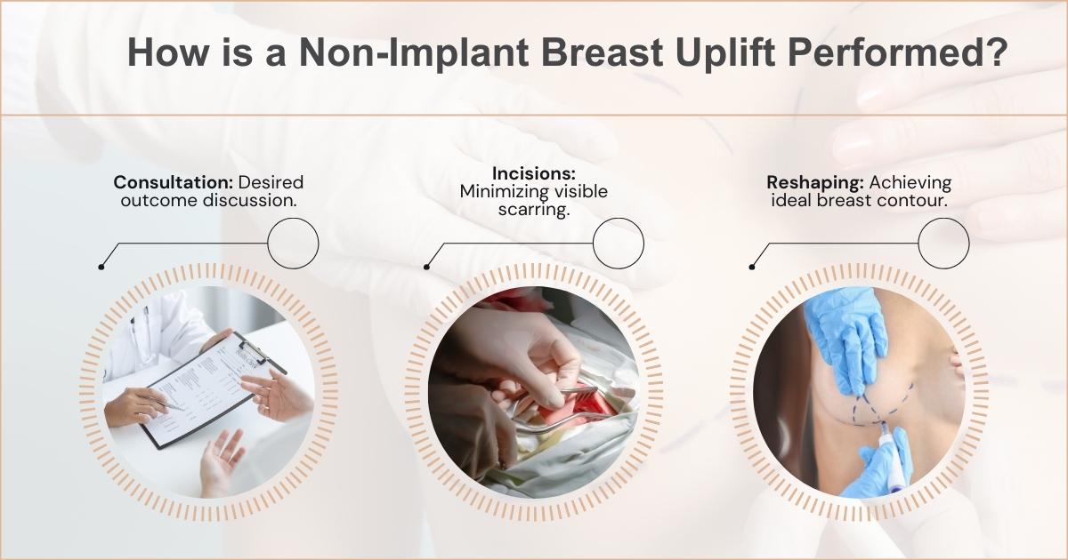 Breast Uplift Without Implants: All You Need To Know