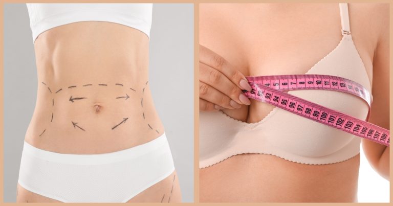 Tummy Tuck and Breast Augmentation