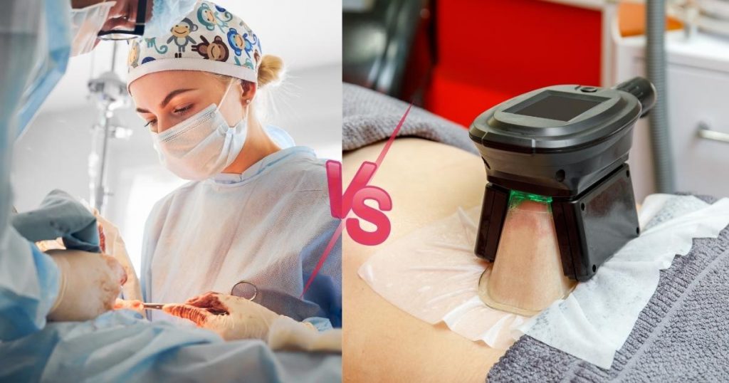 Tummy Tuck Vs. Coolsculpting: Which Is Best For You?
