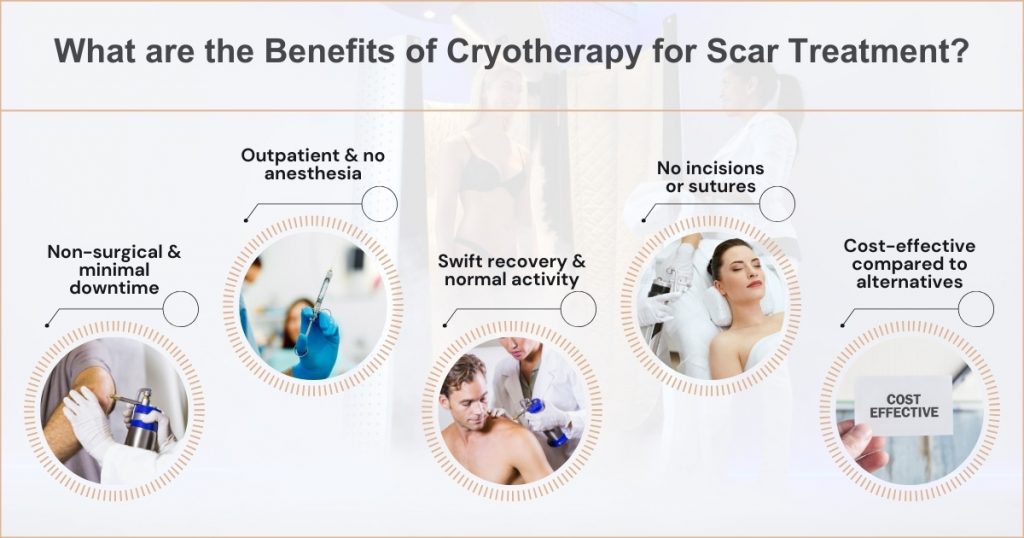 Benefits and Advantages of Using Cryotherapy