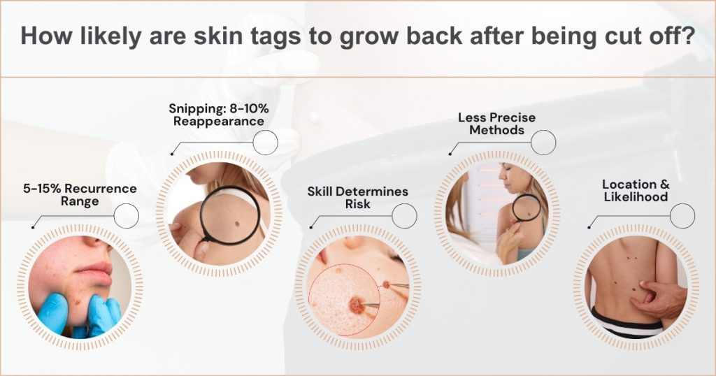 How likely are skin tags to grow back after being cut off