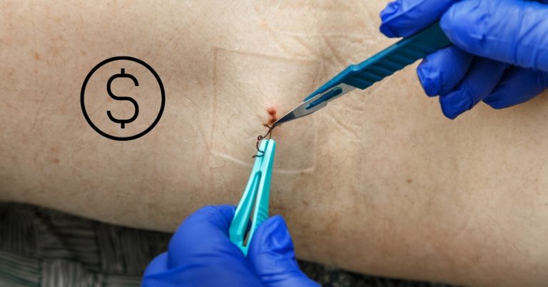Keloid Scar Removal Surgery Cost in Dubai