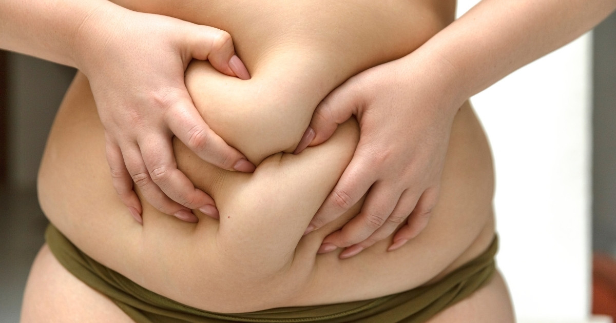 Tummy Tuck Complications_ What to Watch Out For