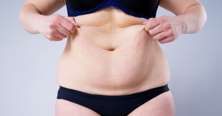 Tummy Tuck Incision Techniques: Which Is Best for You?