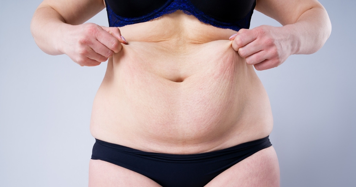 Tummy Tuck Incision Techniques_ Which Is Best for You