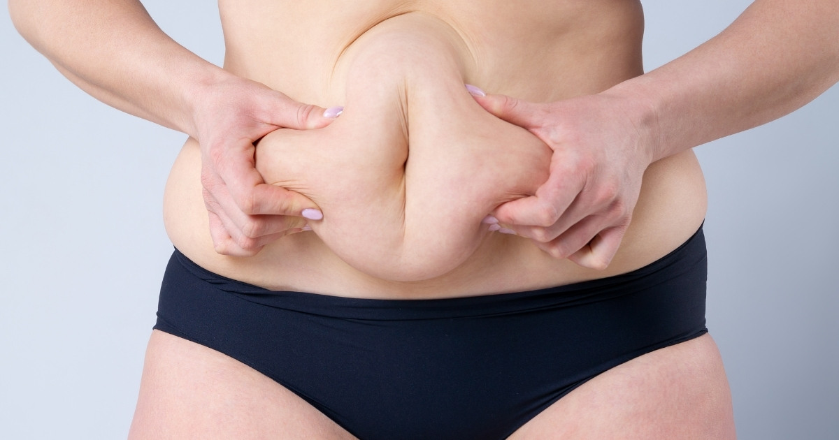 Tummy Tuck Swelling_ What to Expect and How to Manage