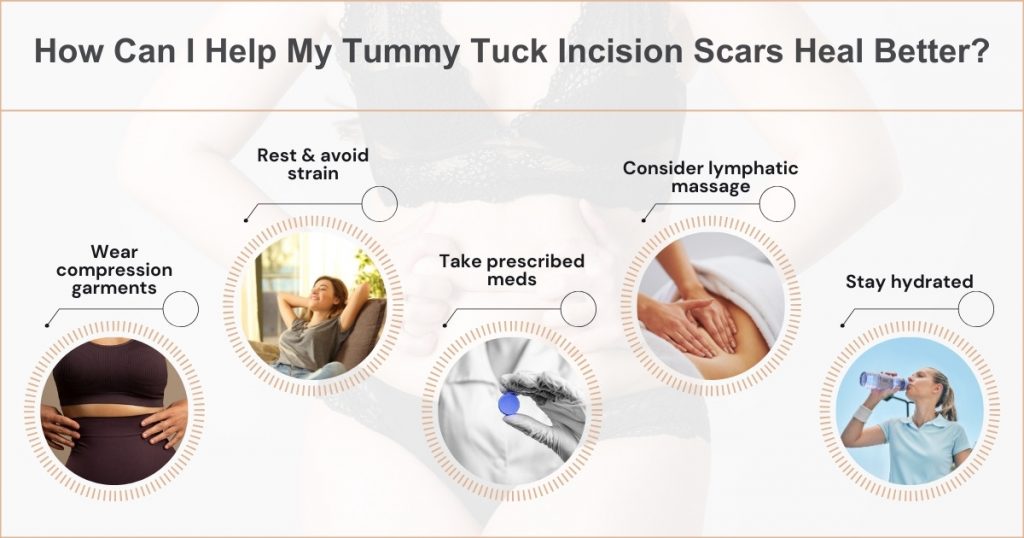 What helps with swelling after a tummy tuck