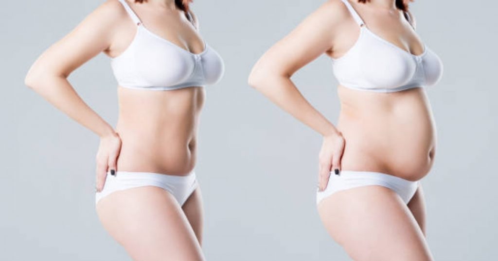 When can I expect to see my final tummy tuck results