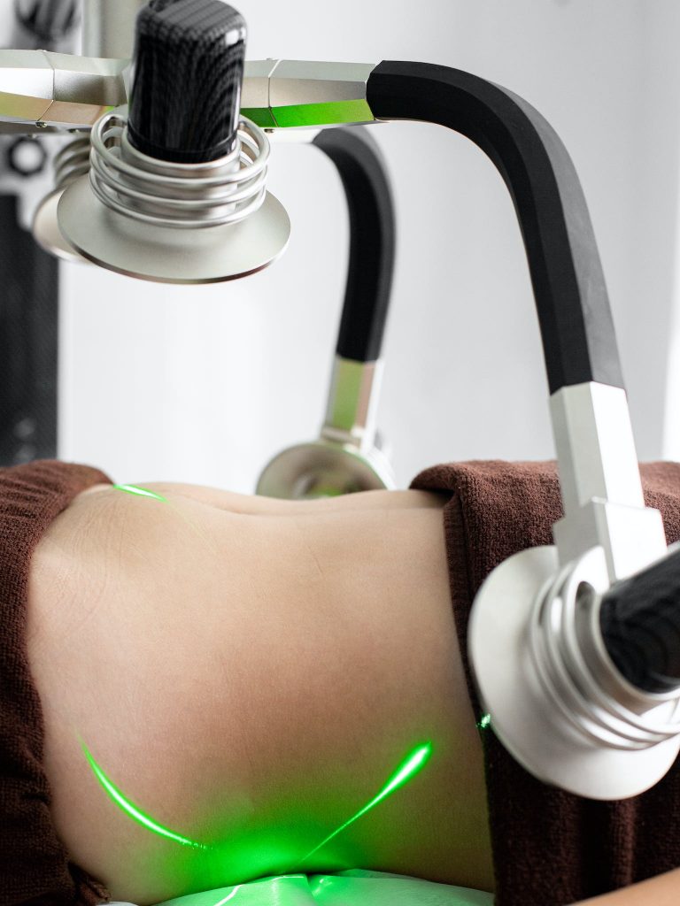 Laser Body Contouring: All You Need to Know