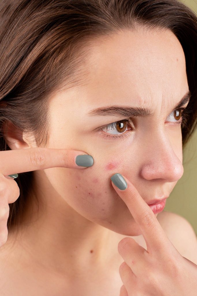 Skin Tag Removal: How Long To Heal