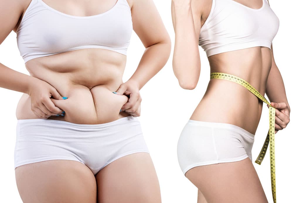 Tummy Tuck and Stress Reduction Techniques