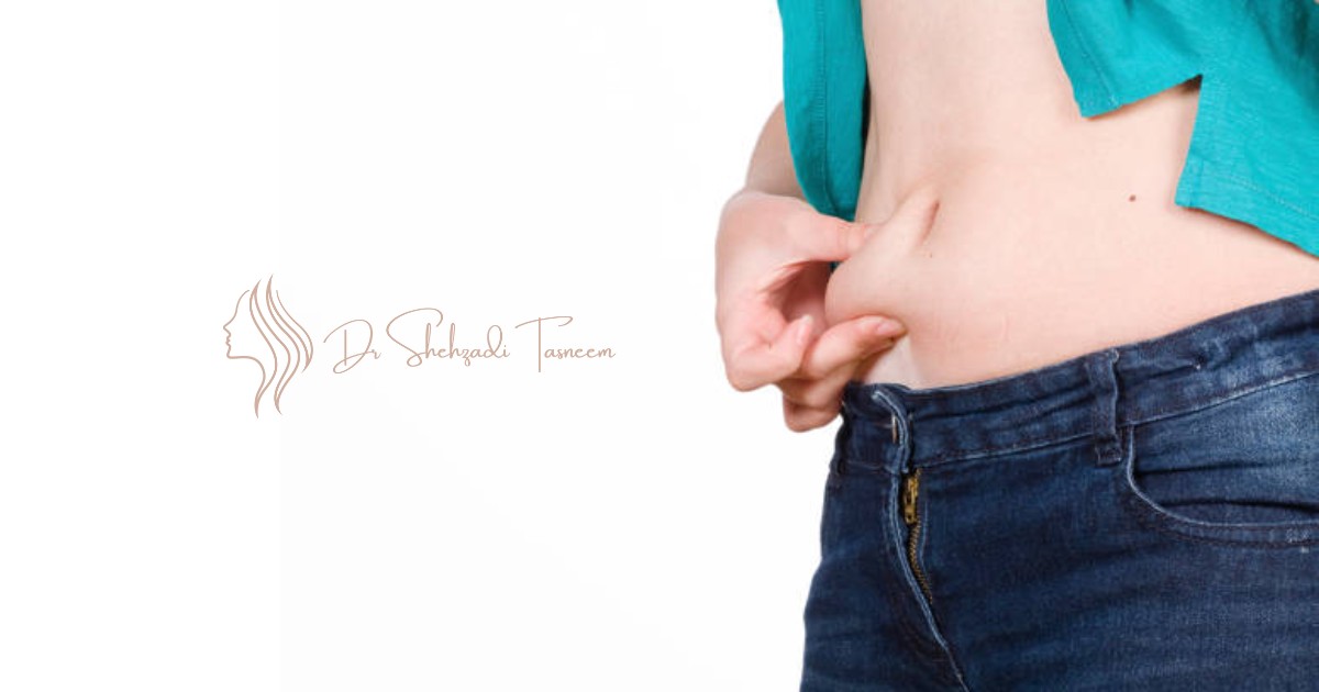 How Do You Know If You Need A Tummy Tuck
