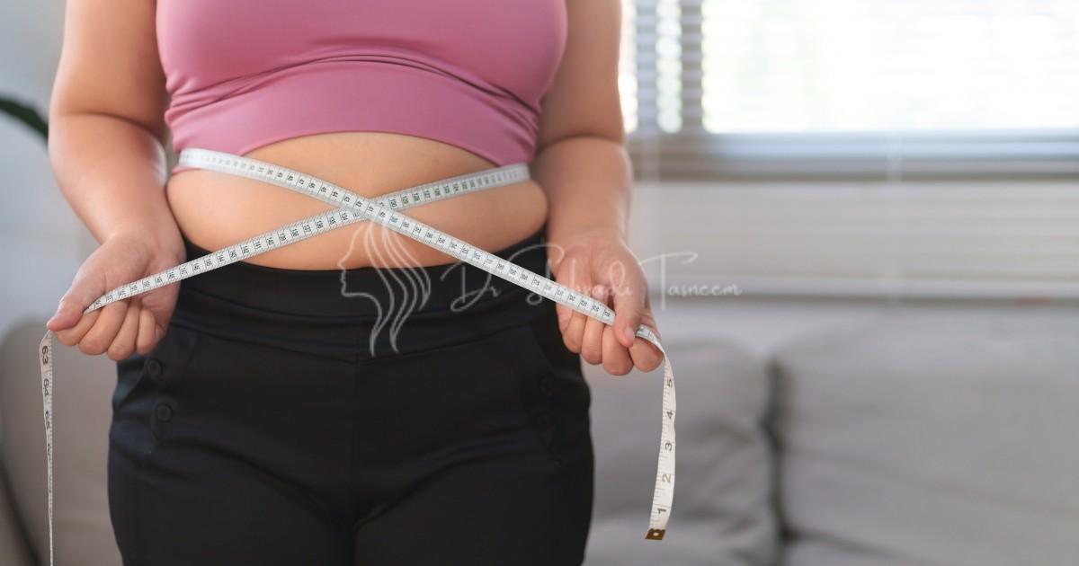 What Is a Reverse tummy Tuck