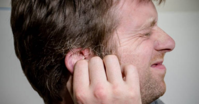 How To Remove A Keloid On The Ear