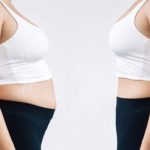 What is Air Liposuction | 2024