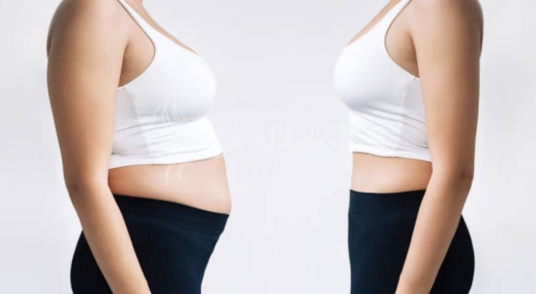 What is Air Liposuction