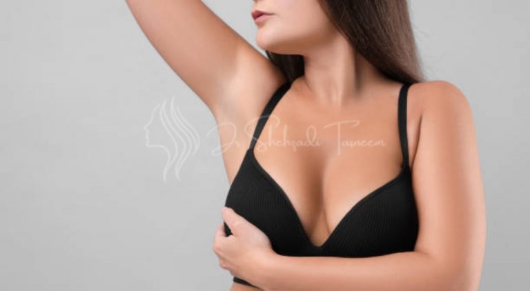 Are Breast Lifts Dangerous 4