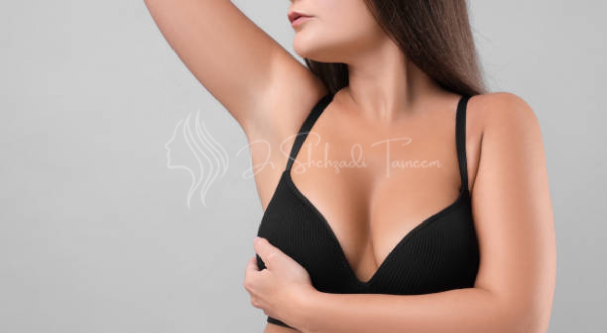 Are Breast Lifts Dangerous 4 | 2024