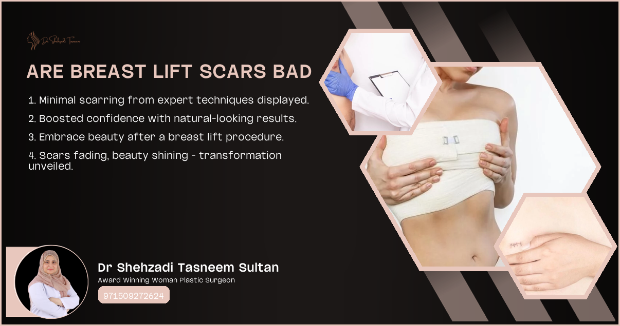 Are Breast Lift Scars Bad | 2024