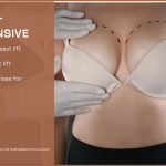 Are Breast Lifts Expensive | 2024