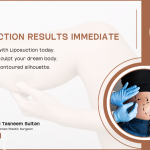 Are Liposuction Results Immediate | 2024